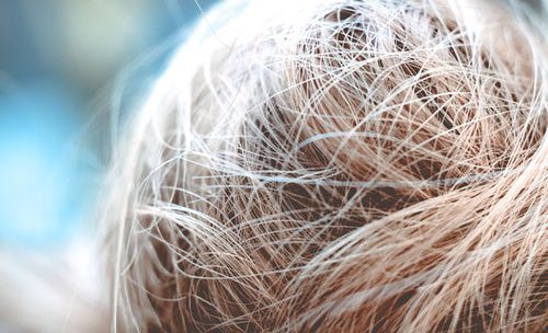 perte_cheveux
